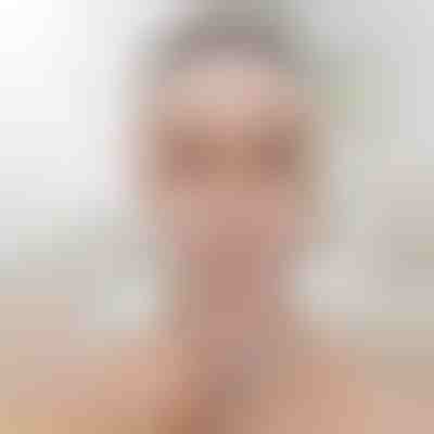 Bandă de lifting pentru sculptarea feței | KIMLIFT